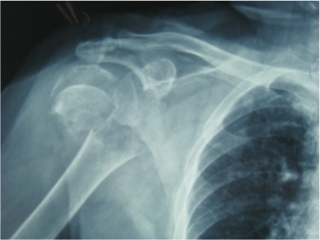 盛京周刊数字报-第五骨科 创伤骨科病房成功完